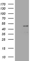 PAX5 Antibody - HEK293T cells were transfected with the pCMV6-ENTRY control (Left lane) or pCMV6-ENTRY PAX5 (Right lane) cDNA for 48 hrs and lysed. Equivalent amounts of cell lysates (5 ug per lane) were separated by SDS-PAGE and immunoblotted with anti-PAX5.