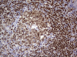 PAX5 Antibody - IHC of paraffin-embedded Human tonsil using anti-PAX5 mouse monoclonal antibody. (Heat-induced epitope retrieval by 10mM citric buffer, pH6.0, 120°C for 3min).