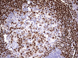 PAX5 Antibody - IHC of paraffin-embedded Human tonsil using anti-PAX5 mouse monoclonal antibody. (Heat-induced epitope retrieval by 10mM citric buffer, pH6.0, 120°C for 3min).