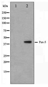 PAX5 Antibody - Western blot of 293 cell lysate using Pax-5 Antibody