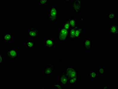 PAX5 Antibody - Immunofluorescence staining of MCF-7 cells with PAX5 Antibody at 1:133, counter-stained with DAPI. The cells were fixed in 4% formaldehyde, permeabilized using 0.2% Triton X-100 and blocked in 10% normal Goat Serum. The cells were then incubated with the antibody overnight at 4°C. The secondary antibody was Alexa Fluor 488-congugated AffiniPure Goat Anti-Rabbit IgG(H+L).