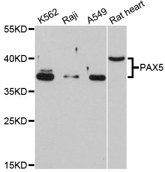 PAX5 Antibody - Western blot analysis of extracts of various cell lines, using PAX5 antibody at 1:1000 dilution. The secondary antibody used was an HRP Goat Anti-Rabbit IgG (H+L) at 1:10000 dilution. Lysates were loaded 25ug per lane and 3% nonfat dry milk in TBST was used for blocking. An ECL Kit was used for detection and the exposure time was 90s.