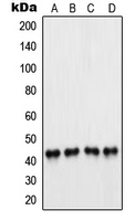 PAX5 Antibody - Western blot analysis of PAX5 expression in A549 (A); Raji (B); K562 (C); U937 (D) whole cell lysates.
