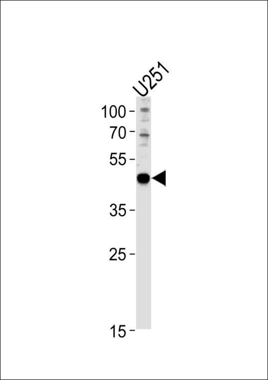 PAX6 Antibody - PAX6 Antibody western blot of U251 cell line lysates (35 ug/lane). The PAX6 antibody detected the PAX6 protein (arrow).