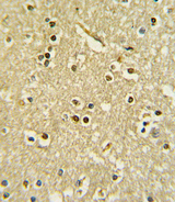 PAX6 Antibody - Formalin-fixed and paraffin-embedded human brain tissue with PAX6 Antibody , which was peroxidase-conjugated to the secondary antibody, followed by DAB staining. This data demonstrates the use of this antibody for immunohistochemistry; clinical relevance has not been evaluated.