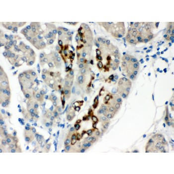 PAX6 Antibody - PAX6 antibody IHC-paraffin. IHC(P): Human Pancreatic Cancer Tissue.