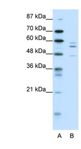 PAX6 Antibody - PAX6 antibody Western blot of HepG2 cell lysate. This image was taken for the unconjugated form of this product. Other forms have not been tested.