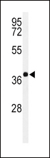 PAX6 Antibody - Western blot of PAX6-T373 in Y79 cell line lysates (35 ug/lane). PAX6 (arrow) was detected using the purified antibody.