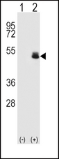 PAX6 Antibody - Western blot of PAX6 (arrow) using rabbit polyclonal PAX6 Antibody (T373). 293 cell lysates (2 ug/lane) either nontransfected (Lane 1) or transiently transfected (Lane 2) with the PAX6 gene.