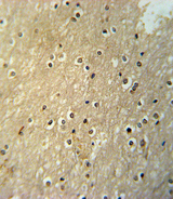 PAX6 Antibody - PAX6-T373 Antibody immunohistochemistry of formalin-fixed and paraffin-embedded human brain tissue followed by peroxidase-conjugated secondary antibody and DAB staining.