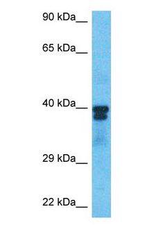 PAX6 Antibody - Western blot of PAX6 Antibody with human 786-0 Whole Cell lysate.  This image was taken for the unconjugated form of this product. Other forms have not been tested.