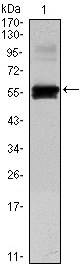 PAX6 Antibody - Western blot using PAX6 monoclonal antibody against human PAX6 (AA: 1-223) recombinant protein. (Expected MW is 50 kDa)