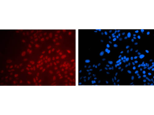 PAX6 Antibody - Immunofluorescence Microscopy of Mouse anti-PAX6 antibody. Tissue: Hela Cell,20X. Fixation: 4% PFA room temp for 10 min. Antigen retrieval: not required. Primary antibody: PAX6 antibody at 1:100 for 1 h at RT. Secondary antibody: goat anti-mouse secondary antibody at 1:1,000 for 45 min at RT. Localization: PAX6 is nuclear. Staining: Merged image of PAX6 as red fluorescent signal with DAPI (blue) nuclear counterstain.