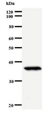PAX6 Antibody - Western blot of immunized recombinant protein using PAX6 antibody.