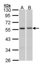 PAX6 Antibody - Sample (30 ug of whole cell lysate). A: A431. B: Hep G2. 10% SDS PAGE. PAX6 antibody diluted at 1:1000. 