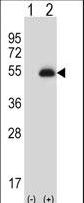 PAX6 Antibody - Western blot of PAX6 (arrow) using rabbit polyclonal PAX6 Antibody. 293 cell lysates (2 ug/lane) either nontransfected (Lane 1) or transiently transfected (Lane 2) with the PAX6 gene.