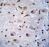 PAX6 Antibody - PAX6 Antibody immunohistochemistry of formalin-fixed and paraffin-embedded human brain tissue followed by peroxidase-conjugated secondary antibody and DAB staining.