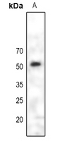PAX6 Antibody - Western blot analysis of PAX6 expression in HEK293T (A) whole cell lysates.