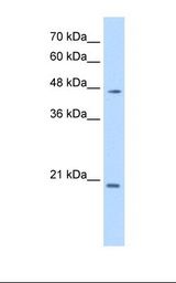 PAX6 Antibody - Jurkat cell lysate. Antibody concentration: 0.25 ug/ml. Gel concentration: 12%.  This image was taken for the unconjugated form of this product. Other forms have not been tested.