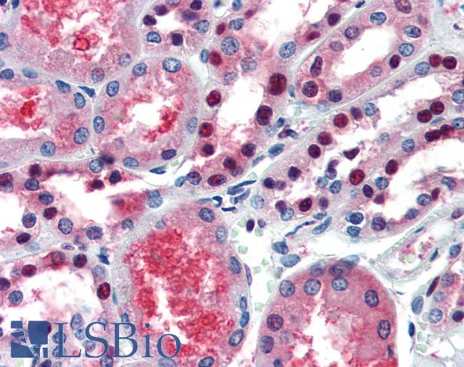 PAX7 Antibody - Anti-PAX7 antibody IHC of human kidney. Immunohistochemistry of formalin-fixed, paraffin-embedded tissue after heat-induced antigen retrieval. Antibody concentration 5 ug/ml.  This image was taken for the unconjugated form of this product. Other forms have not been tested.