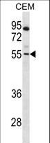PAX7 Antibody - PAX7 Antibody western blot of CEM cell line lysates (35 ug/lane). The PAX7 antibody detected the PAX7 protein (arrow).
