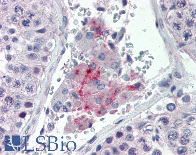 PAX7 Antibody - Anti-PAX7 antibody IHC of human testis. Immunohistochemistry of formalin-fixed, paraffin-embedded tissue after heat-induced antigen retrieval. Antibody concentration 10 ug/ml.  This image was taken for the unconjugated form of this product. Other forms have not been tested.