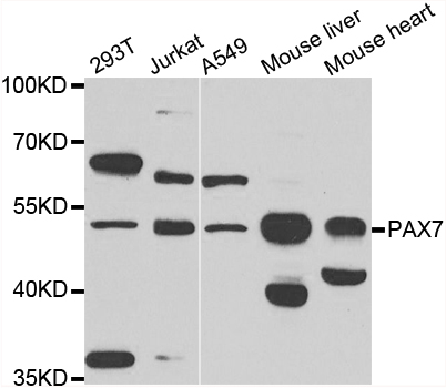 PAX7 Antibody - Western blot analysis of extracts of various cell lines.