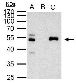 PAX8 Antibody - PAX8 antibody immunoprecipitates PAX8 protein in IP experiments. IP Sample:1000 ug 293T whole cell lysate/extract A. 40 ug 293T whole cell lysate/extract B. Control with 2 ug of preimmune rabbit IgG C. Immunoprecipitation of PAX8 protein by 2 ug of PAX8 antibody 10% SDS-PAGE The immunoprecipitated PAX8 protein was detected by PAX8 antibody diluted at 1:1000. EasyBlot anti-rabbit IgG (anti-rabbit IgG (HRP) -01) was used as a secondary reagent.