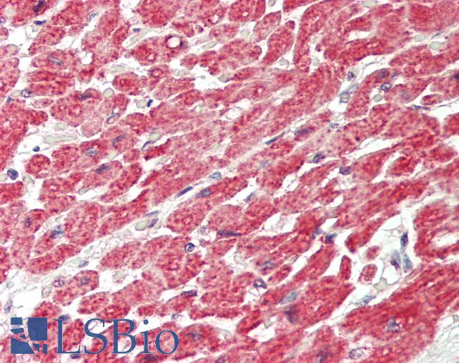 PAX8 Antibody - Human Heart: Formalin-Fixed, Paraffin-Embedded (FFPE).  This image was taken for the unconjugated form of this product. Other forms have not been tested.