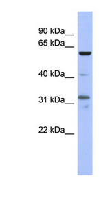 PAX8 Antibody - PAX8 antibody Western blot of NCI-H226 cell lysate. This image was taken for the unconjugated form of this product. Other forms have not been tested.