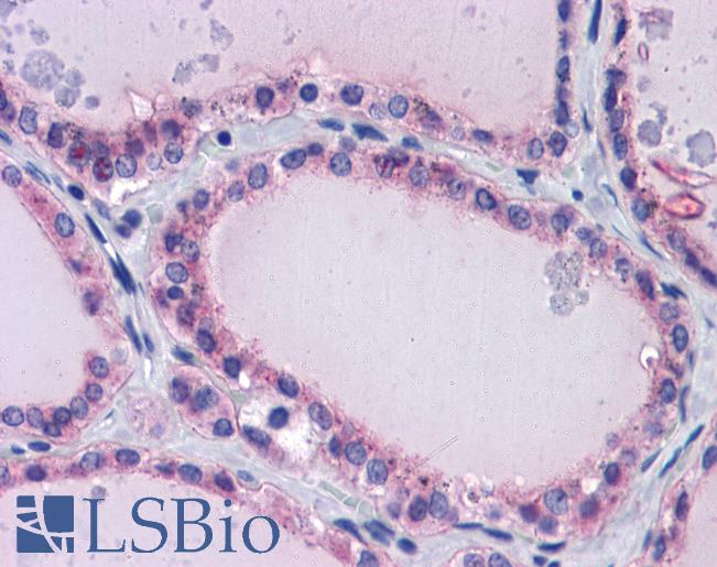 PAX8 Antibody - Anti-PAX8 antibody IHC of human thyroid. Immunohistochemistry of formalin-fixed, paraffin-embedded tissue after heat-induced antigen retrieval. Antibody concentration 5 ug/ml.  This image was taken for the unconjugated form of this product. Other forms have not been tested.