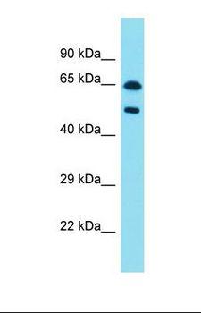 PAX8 Antibody - Western blot of Human Pancreas Tumor. PAX8 antibody dilution 1.0 ug/ml.  This image was taken for the unconjugated form of this product. Other forms have not been tested.