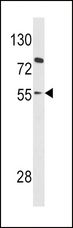 PAX8 Antibody - Western blot of PAX8 Antibody in HL-60 cell line lysates (35 ug/lane). PAX8 (arrow) was detected using the purified antibody.