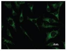 PAX8 Antibody - Immunofluorescent staining using PAX8 antibody. Immunostaining analysis in HeLa cells. HeLa cells were fixed with 4% paraformaldehyde and permeabilized with 0.01% Triton-PAX8 in PBS. The cells were immunostained with anti-GATAD1 antibody.