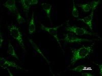 PAX8 Antibody - Immunostaining analysis in HeLa cells. HeLa cells were fixed with 4% paraformaldehyde and permeabilized with 0.1% Triton X-100 in PBS. The cells were immunostained with anti-PAX8 mAb.