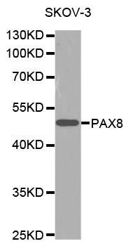 PAX8 Antibody - Western blot analysis of extracts of SKOV3 cells, using PAX8 antibody. The secondary antibody used was an HRP Goat Anti-Rabbit IgG (H+L) at 1:10000 dilution. Lysates were loaded 25ug per lane and 3% nonfat dry milk in TBST was used for blocking.