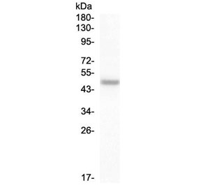 PAX8 Antibody - Western blot testing of human SW579 cell lysate with PAX8 antibody at 0.5ug/ml. Predicted molecular weight ~48 kDa but also observed at 55-60 kDa.