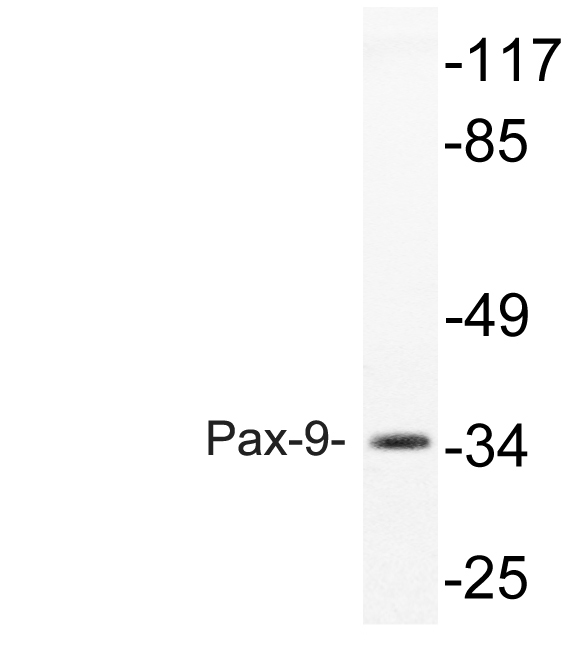 PAX9 Antibody - Western blot analysis of lysate from rat heart, using Pax-9 antibody.