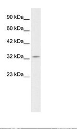 PAX9 Antibody - Jurkat Cell Lysate.  This image was taken for the unconjugated form of this product. Other forms have not been tested.