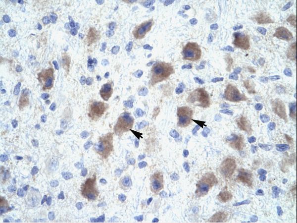 PAX9 Antibody - PAX9 antibody ARP34270_P050-NP_006185-PAX9 (paired box gene 9) Antibody was used in IHC to stain formalin-fixed, paraffin-embedded human brain.  This image was taken for the unconjugated form of this product. Other forms have not been tested.