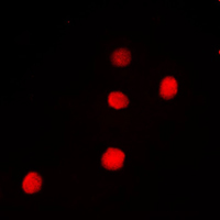 PAX9 Antibody - Immunofluorescent analysis of PAX9 staining in Jurkat cells. Formalin-fixed cells were permeabilized with 0.1% Triton X-100 in TBS for 5-10 minutes and blocked with 3% BSA-PBS for 30 minutes at room temperature. Cells were probed with the primary antibody in 3% BSA-PBS and incubated overnight at 4 C in a humidified chamber. Cells were washed with PBST and incubated with a DyLight 594-conjugated secondary antibody (red) in PBS at room temperature in the dark. DAPI was used to stain the cell nuclei (blue).
