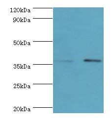 PBK / TOPK Antibody - Western blot. All lanes: PBK antibody at 6 ug/ml. Lane 1: HeLa whole cell lysate. Lane 2: mouse gonad tissue. Secondary antibody: Goat polyclonal to rabbit at 1:10000 dilution. Predicted band size: 36 kDa. Observed band size: 36 kDa Immunohistochemistry.