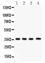 PBK / TOPK Antibody - PBK antibody Western blot. All lanes: Anti PBK at 0.5 ug/ml. Lane 1: Rat Testis Tissue Lysate at 50 ug. Lane 2: Mouse Testis Tissue Lysate at 50 ug. Lane 3: Human Placenta Tissue Lysate at 50 ug. Lane 4: JURKAT Whole Cell Lysate at 40 ug. Predicted band size: 36 kD. Observed band size: 36 kD.