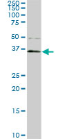 PBK / TOPK Antibody - PBK monoclonal antibody (M07), clone 3A7. Western blot of PBK expression in Y-79.