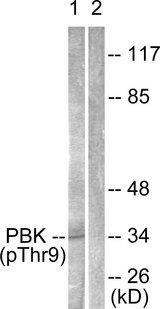 PBK / TOPK Antibody - Western blot analysis of lysates from K562 cells treated with UV 30', using PBK/TOPK (Phospho-Thr9) Antibody. The lane on the right is blocked with the phospho peptide.