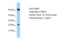 PBOV1 Antibody -  This image was taken for the unconjugated form of this product. Other forms have not been tested.