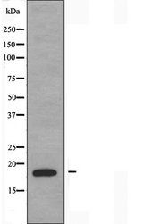 PBOV1 Antibody - Western blot analysis of extracts of K562 cells using PBOV1 antibody.