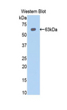 PBRM1 / BAF180 / PB1 Antibody - Western blot of recombinant PBRM1 / BAF180 / PB1.  This image was taken for the unconjugated form of this product. Other forms have not been tested.