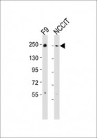 PBRM1 / BAF180 / PB1 Antibody - All lanes : Anti-PBRM1 Antibody at 1:2000 dilution Lane 1: F9 whole cell lysates Lane 2: NCCIT whole cell lysates Lysates/proteins at 20 ug per lane. Secondary Goat Anti-Rabbit IgG, (H+L), Peroxidase conjugated at 1/10000 dilution Predicted band size : 193 kDa Blocking/Dilution buffer: 5% NFDM/TBST.