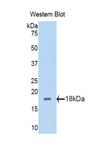 PBRM1 / BAF180 / PB1 Antibody - Western blot of PBRM1 / BAF180 / PB1 antibody.